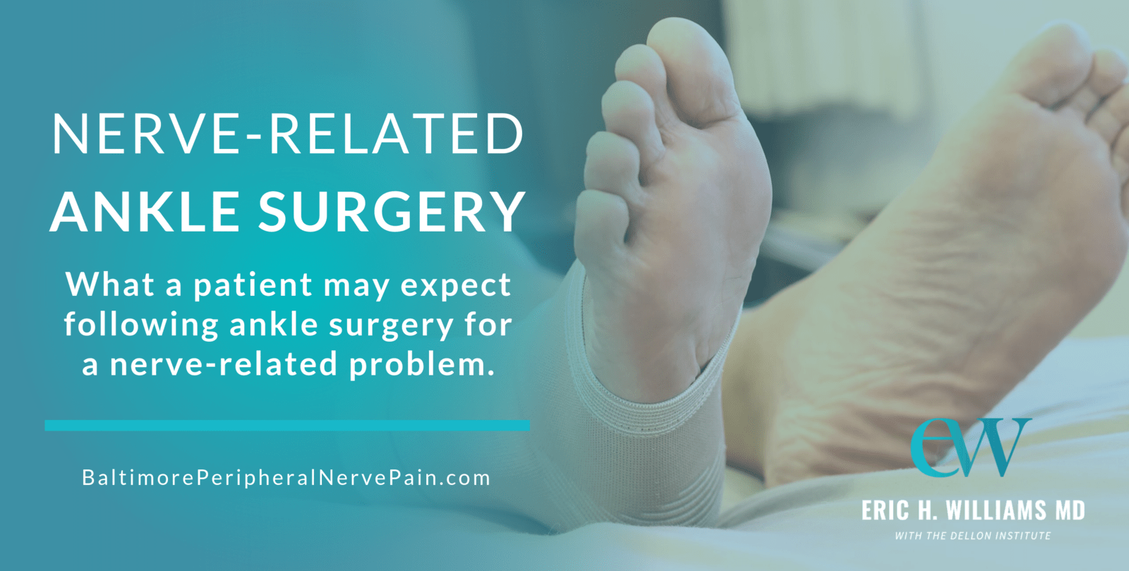 What To Expect from NerveRelated Ankle Surgery Post Surgical Pain